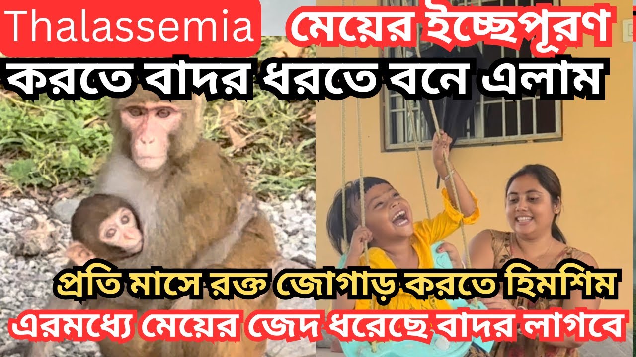 Hair Transplant Graft Guide: How Many Do You Really Need?