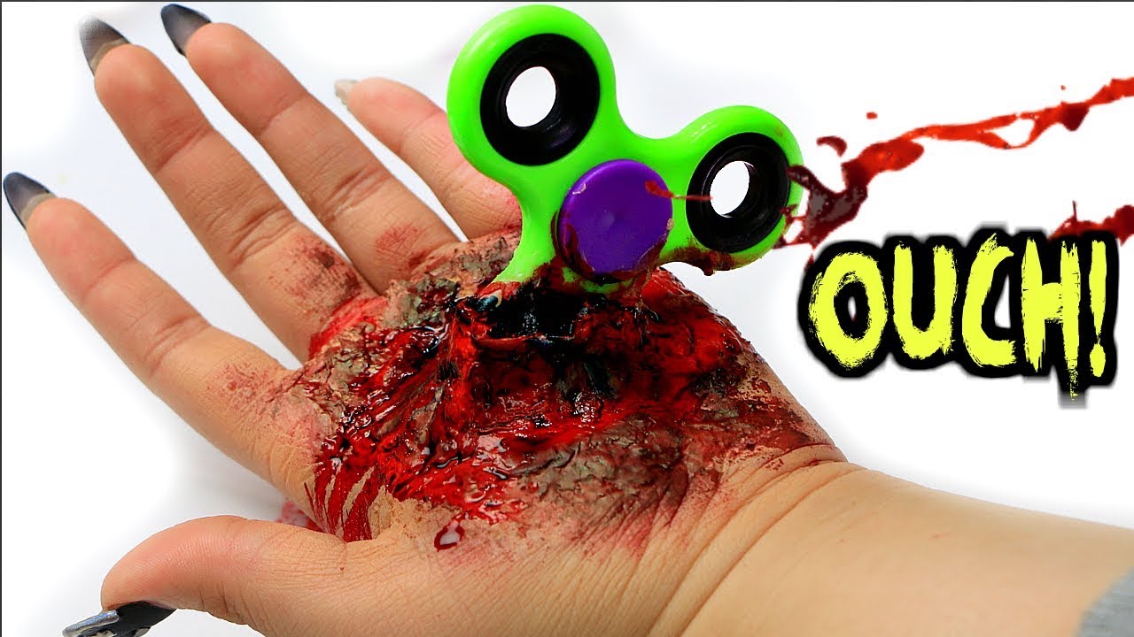 DIY Fidget Spinner Halloween Injury: Step-by-Step Guide