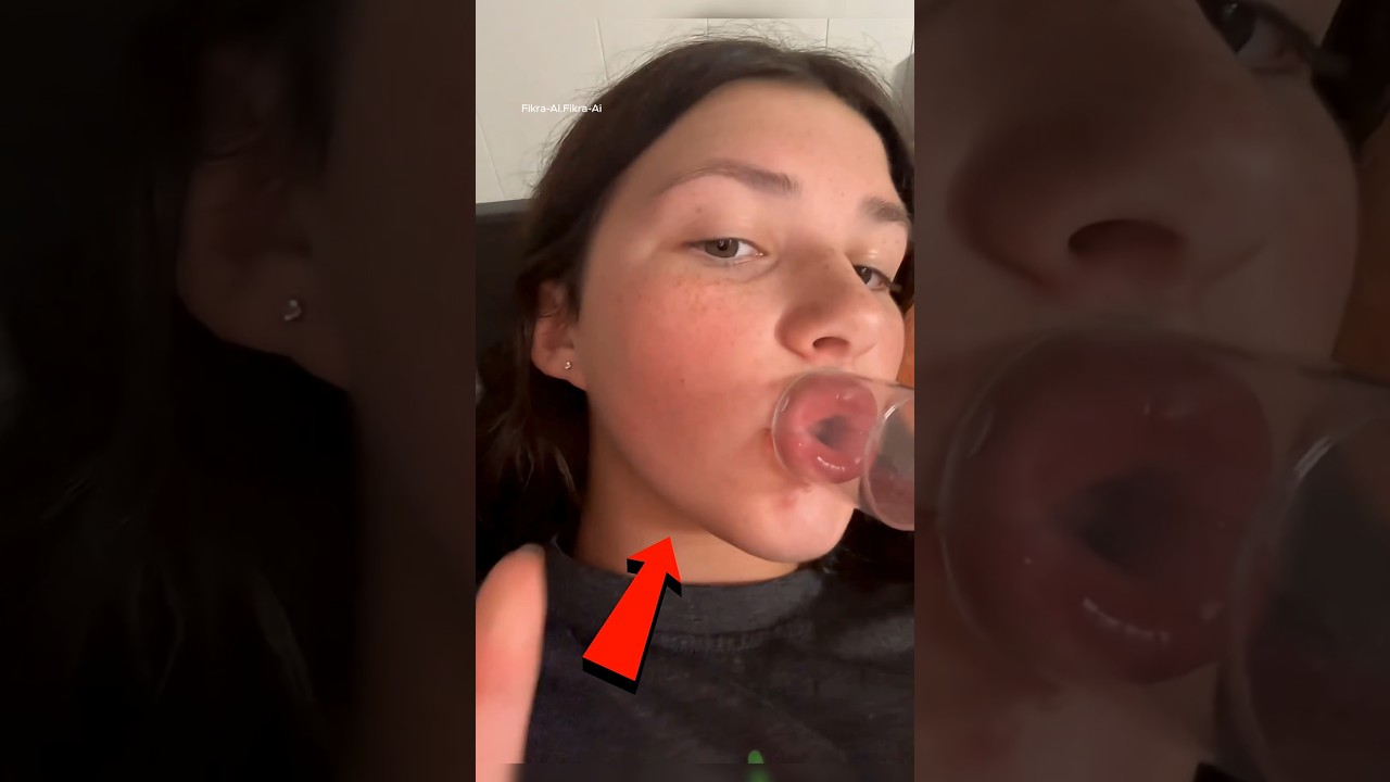 Lip Suction Risks: Why DIY Plumping Fails (Safer Alternatives)