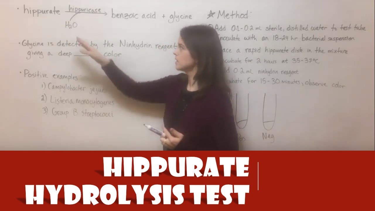 Hippurate Hydrolysis Test: Principle and Clinical Use