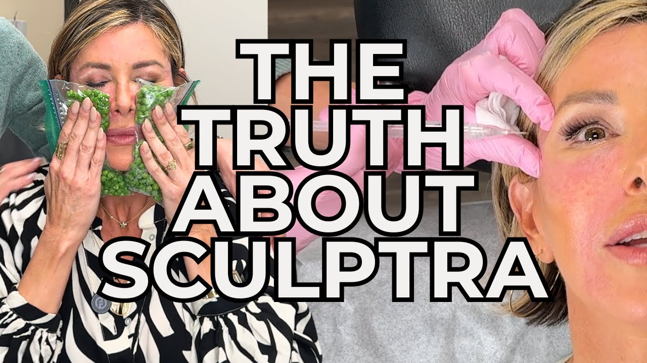 Sculptra vs. Fillers: Natural Anti-Aging Results That Last 3+ Years