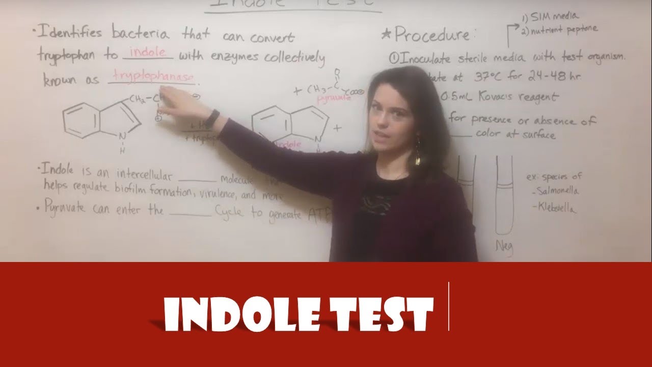 Indole Test Explained: Identifying Bacteria Through Biochemical Analysis