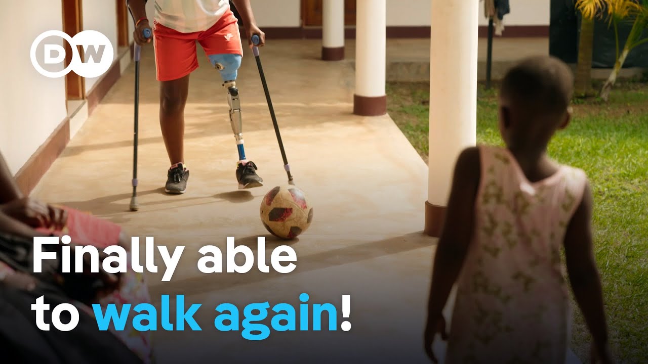 Transforming Lives: Prosthetic Care for Uganda's Disabled Community