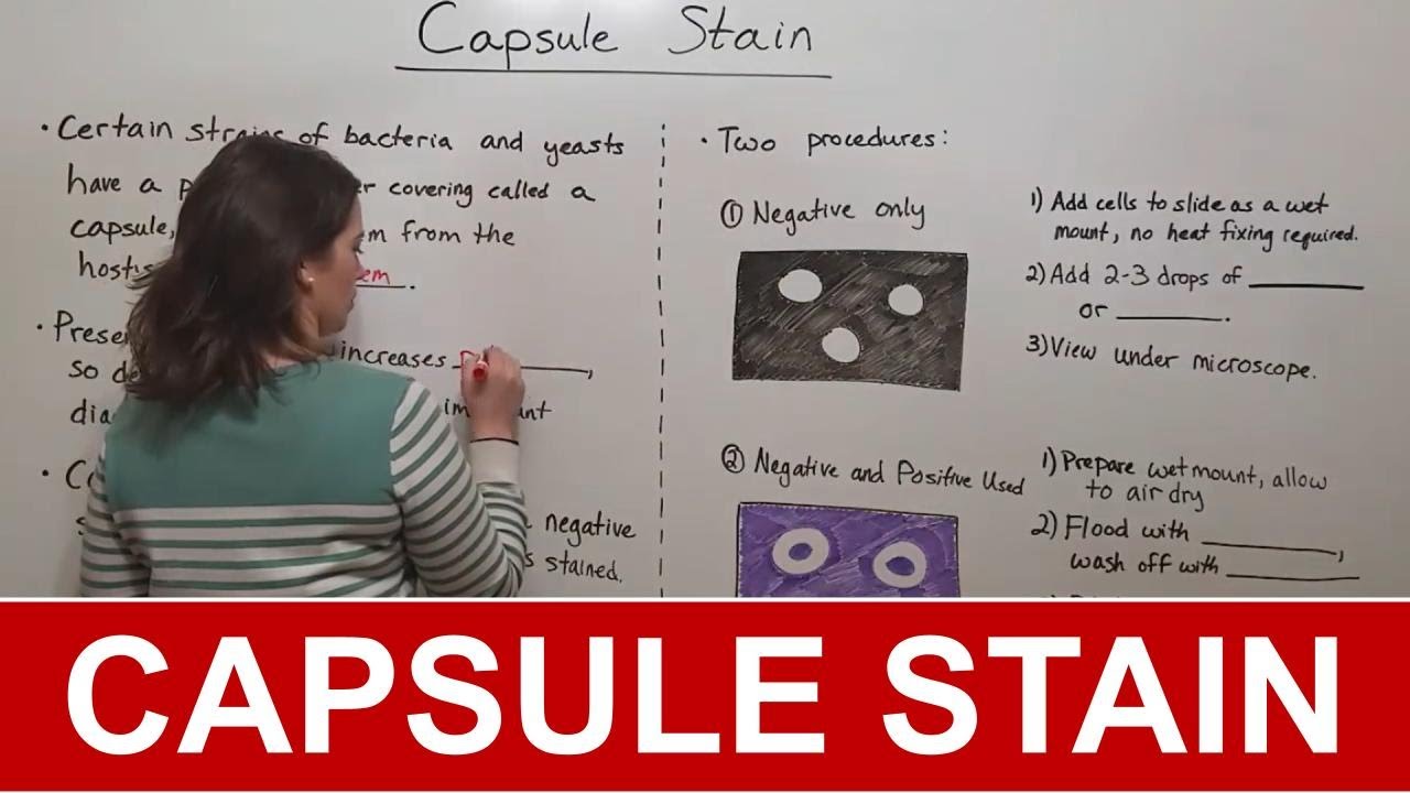 Capsule Stain Procedure: Step-by-Step Microbiology Guide