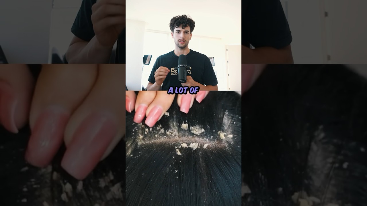 Dandruff vs Dry Scalp: Fix Flakes With Right Shampoo