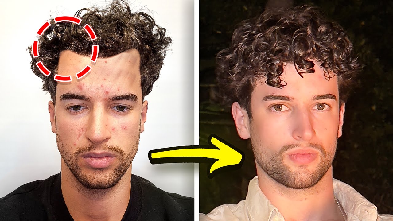 Prevent Male Hair Loss: Diet Fixes & Proven Treatments Guide