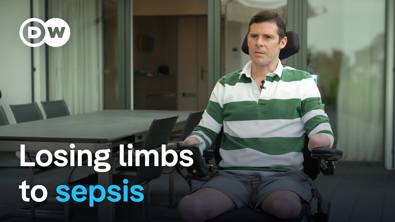 Surviving Sepsis: A Quadruple Amputee's Recovery Journey
