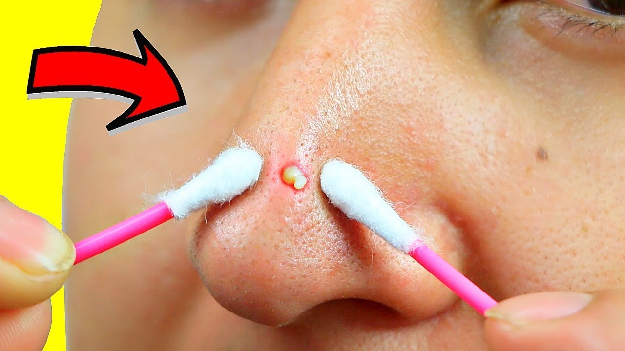 10 Genius Prom Beauty Hacks for Flawless Confidence