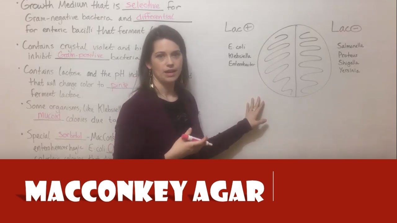 MacConkey Agar Guide: Selective & Differential Media Explained