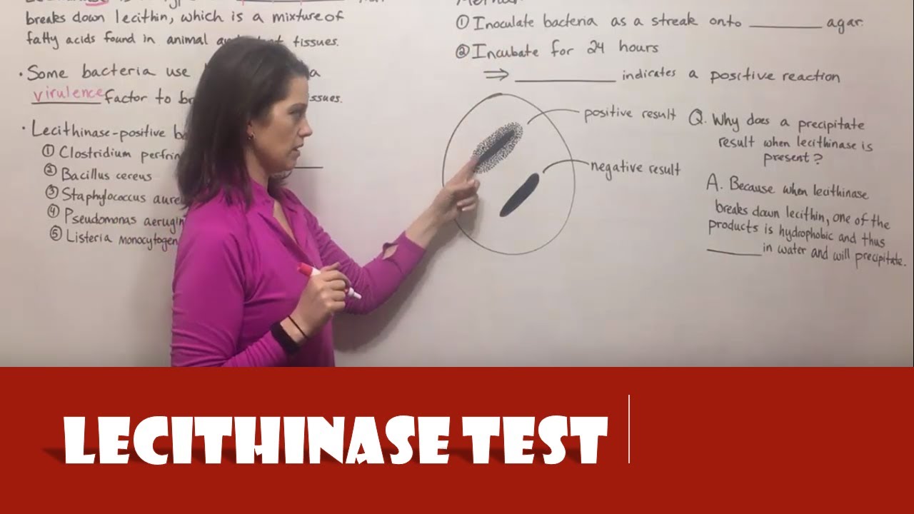 Lecithinase Test: Principle, Procedure & Clinical Significance
