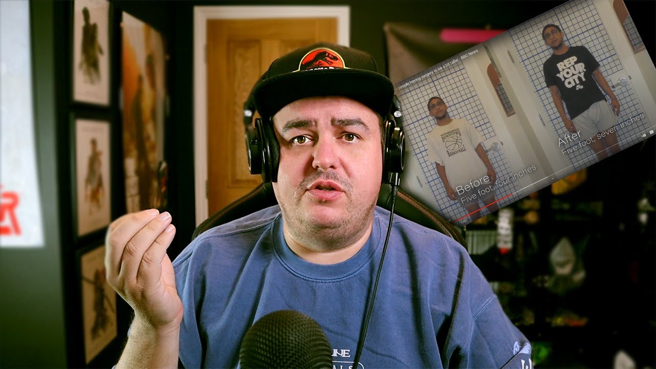 Leg Lengthening Surgery Risks: Why Height Isn't Worth the Pain